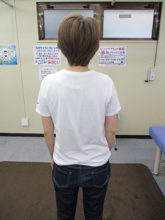 施術後の後ろ姿